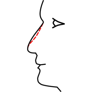 diagram of snoring