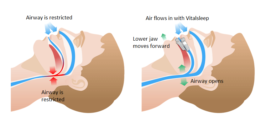vital sleep - how it works